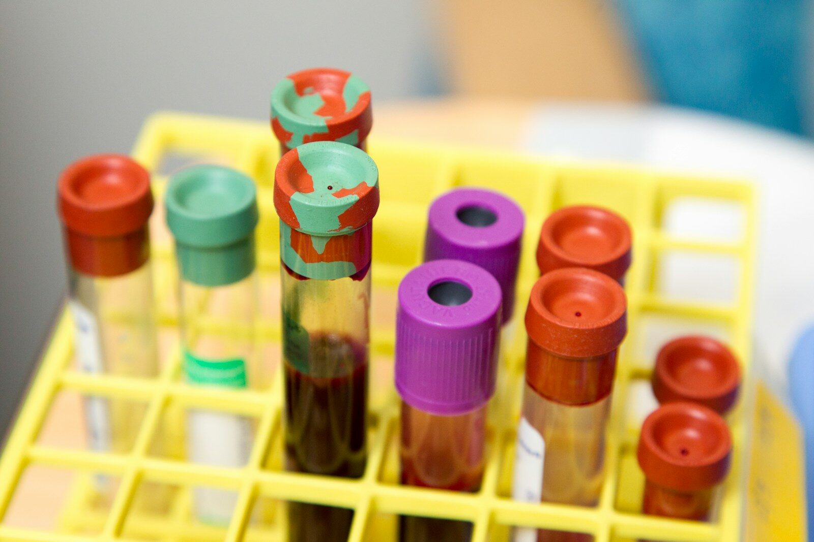 The Blood Tests Worth Paying For